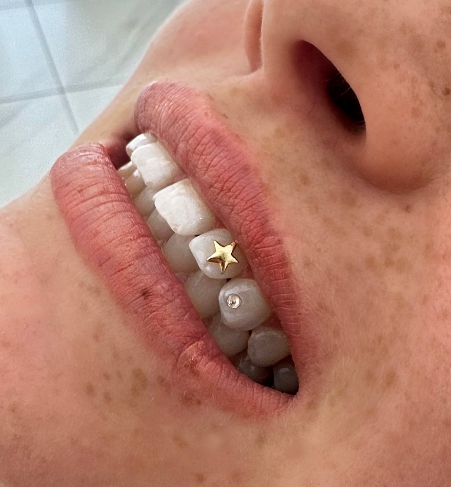 Gold Star Gem On Tooth Price Star Teeth Grill - Main Image